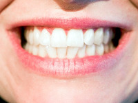 Zubn korunky jako prav zuby  na Brandeis Clinic je umme!